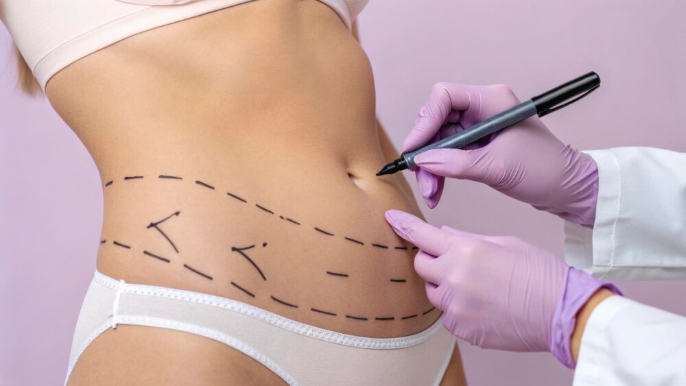 Body Contouring After GLP-1 Weight Loss: What Newport Beach Patients Need to Know in 2025